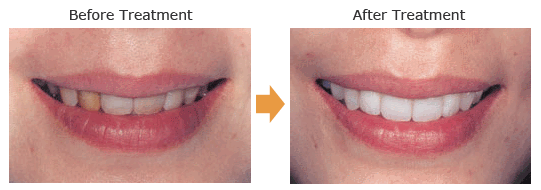 What is Cosmetic dentistry